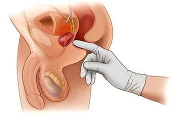 Masage Prostate